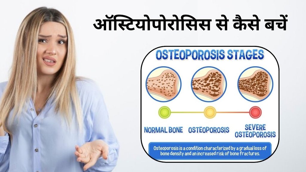 women troubles Osteoporosis: ऑस्टियोपोरोसिस से कैसे बचें