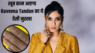 Raveena Tandon । Raveena Tandon Photos । Dry hands in Winter