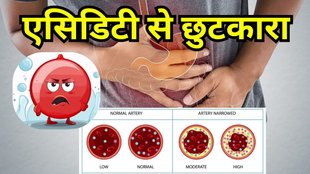 Reduce Acidity: एसिडिटी से छुटकारा