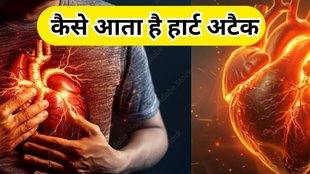 Kaise Aata Hai Heart Attack हार्ट अटैक कैसे आता है।