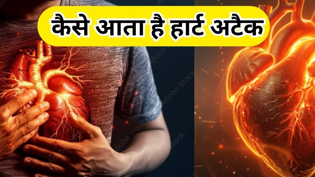 Kaise Aata Hai Heart Attack हार्ट अटैक कैसे आता है।