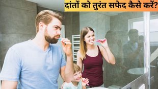 Teeth Whitening Tips । white teeth । Yellow teeth