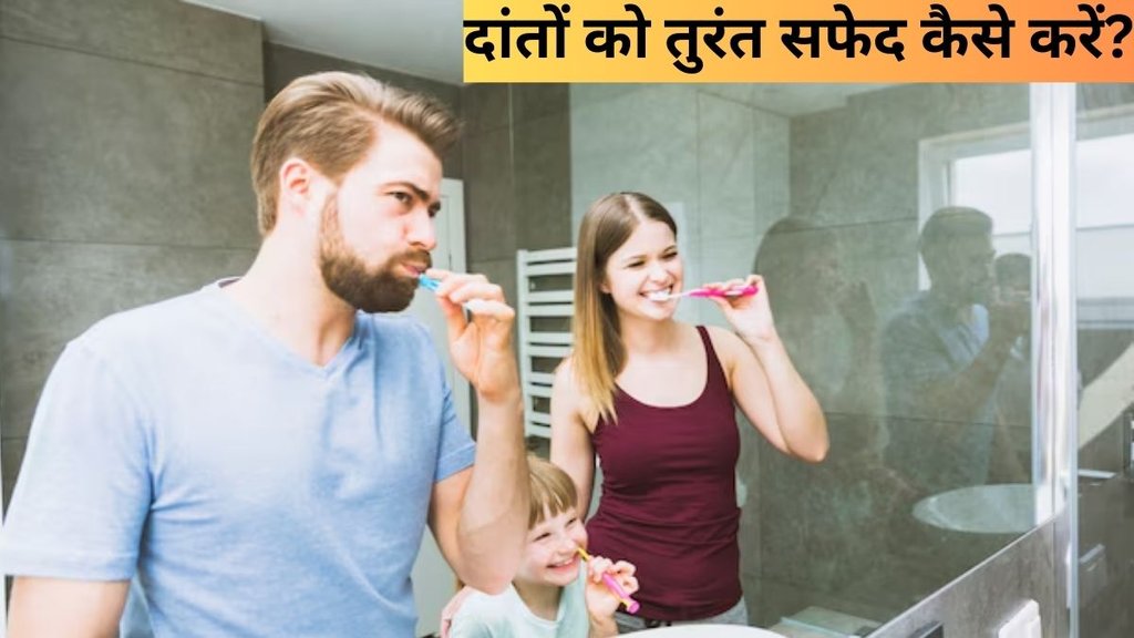 Teeth Whitening Tips । white teeth । Yellow teeth
