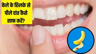 how to clean yellow teeth with banana peel