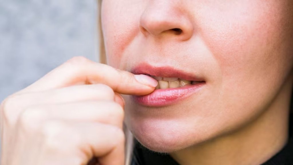 Winter Dry Lips । Dry Lips । Dry Lips for Winter