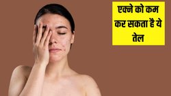 चेहरे पर एक्ने को कम कर सकता है ये तेल, डर्मेटोलॉजिस्ट से जानें फायदे और इस्तेमाल करने का तरीका