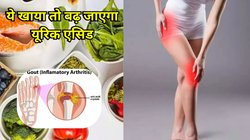 Uric Acid: इन चीजों का किया सेवन तो तेजी से बढ़ जाएगा यूरिक एसिड, किडनी और गठिया की भी हो सकती है परेशानी