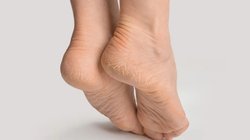 सर्दियों में हर बार फट जाती हैं एडियां? ट्राई करें ये आसान हैक्स, 2 दिनों में ठीक हो जाएंगी Cracked Heels