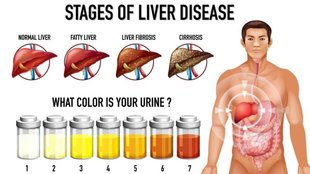 damage on liver: लिवर के लिए हानिकारक है ये ड्रिंक