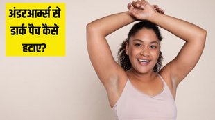 How can I remove underarm darkness । How to clean underarms । Dark underarms