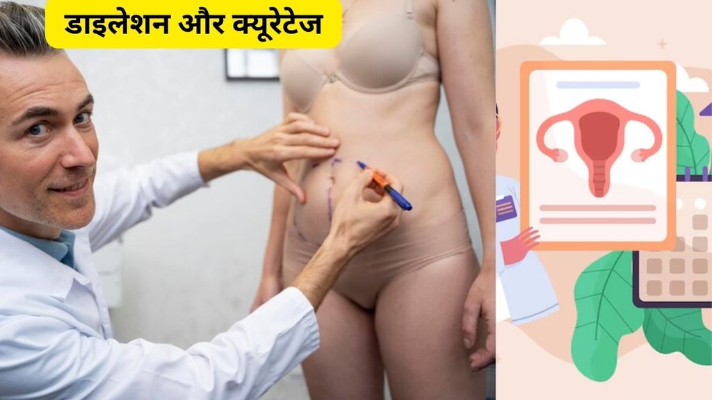 Dilation and curettage, uterus, dnc kya hota hai, dnc kaise hota hai, dnc me kya hota hai, dnc kab hoti hai, bache dani ki safai, bache dani ki safai kaise ki jati hai,