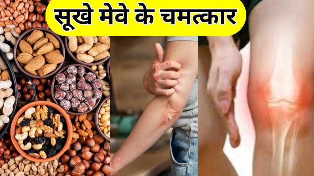 dry fruits for uric acid