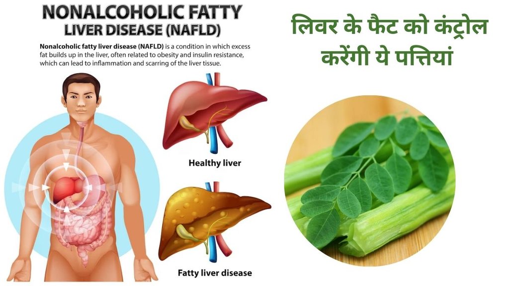 Moringa Benefits For Body, मोरिंगा के फायदे, मोरिंगा की पत्तियां खाने के फायदे, मोरिंगा लेने का सबसे अच्छा तरीका, सहजन क्यों फायदेमंद है, Moringa aur Sahjan ke fayde, moringa Leafs benefits
