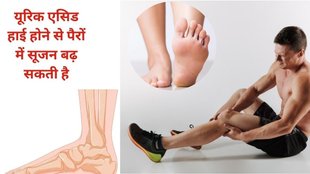 Uric Acid, uric acid symptoms, high uric acid problem, how to check uric acid in body, uric acid causes, uric acid reasons, uric acid test, uric acid patients, uric acid remedy, uric acid home remedy, home remedy for uric acid, uric acid symptoms in hindi, uric acid treatment, uric acid foods, uric acid pain