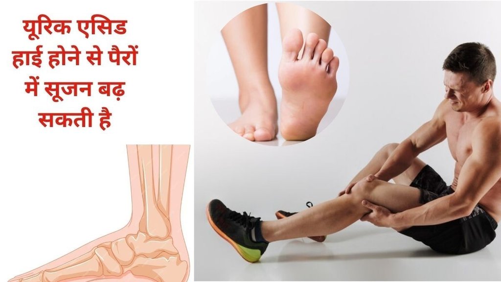 Uric Acid, uric acid symptoms, high uric acid problem, how to check uric acid in body, uric acid causes, uric acid reasons, uric acid test, uric acid patients, uric acid remedy, uric acid home remedy, home remedy for uric acid, uric acid symptoms in hindi, uric acid treatment, uric acid foods, uric acid pain