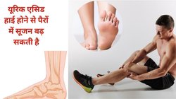 यूरिक एसिड बढ़ने पर एड़ियों और पैरों में दिखते हैं ये 5 लक्षण, दर्द से छुटकारा पाने के लिए तुरंत करें पहचान, टल सकता है गाउट का खतरा