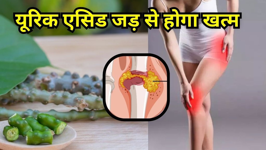 giloy for uric acid: गिलोय से कम होगा यूरिक एसिड
