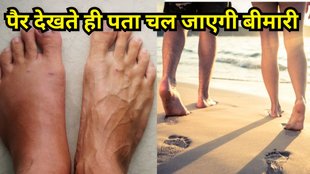 health tips: पैर देखकर जानें शरीर की बीमारी