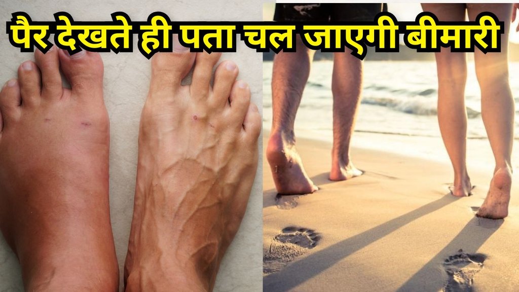 health tips: पैर देखकर जानें शरीर की बीमारी