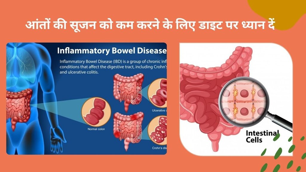 Crohn's disease sign, Crohn's disease symptoms, how to control Crohn's disease,intestine swelling and pain,diet for Crohn's disease,What foods are good for Crohn's disease,