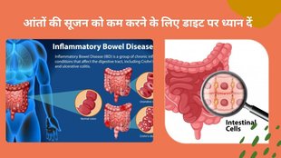 Crohn's disease sign, Crohn's disease symptoms, how to control Crohn's disease,intestine swelling and pain,diet for Crohn's disease,What foods are good for Crohn's disease,