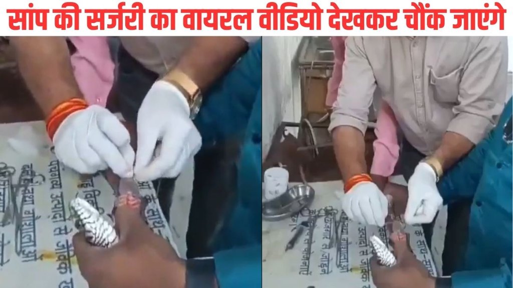 Narmadpuram, snake video, snake surgery