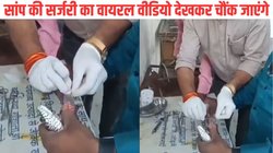 घायल सांप को अस्पताल लेकर पहुंचे लोग, डॉक्टर ने दिया एनेस्थीसिया, लगाए 9 टांके और…, सर्जरी का VIDEO VIRAL