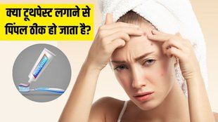 Is toothpaste good for pimples । Can ice remove pimples । Is toothpaste good for skin