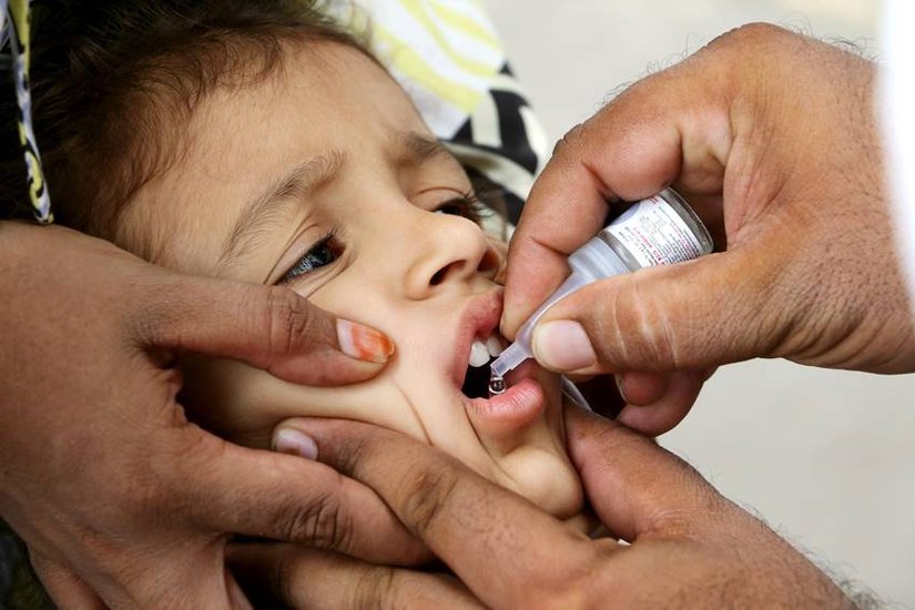symptoms of polio