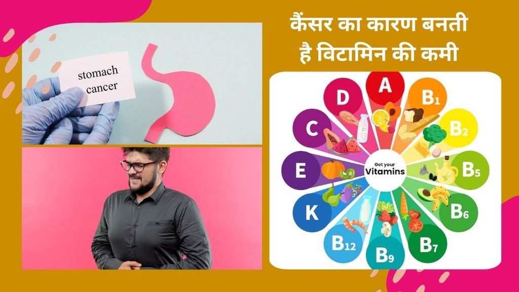 vitamin deficiency, lack of vitamins cause cancer, cancer and vitamin deficiency, vitamin D deficiency,bladder cancer, vitamin C deficiency,stomach lungs cancer,