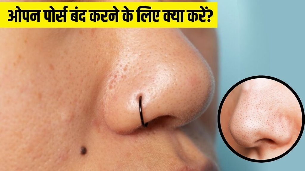 Open pores । How to remove open pores from face । Skin Care tips