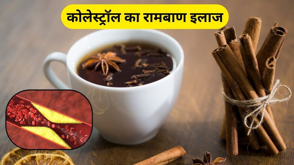 How to Control Cholesterol: हाई कोलेस्‍ट्रॉल को कंट्रोल कैसे करें।