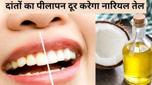 Coconut Oil For Yellow Teeth। Coconut Oil । Yellow Teeth