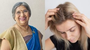 Dr. Hansaji Yogendra । Dr. Hansaji Yogendra hair care tips । Dandruff । Dandruff Remedies