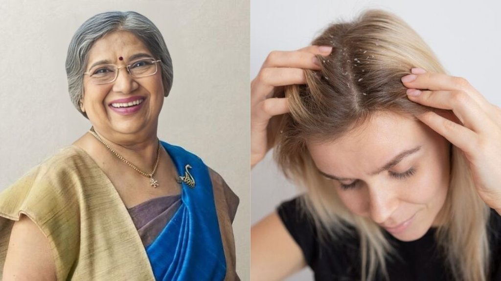 Dr. Hansaji Yogendra । Dr. Hansaji Yogendra hair care tips । Dandruff । Dandruff Remedies