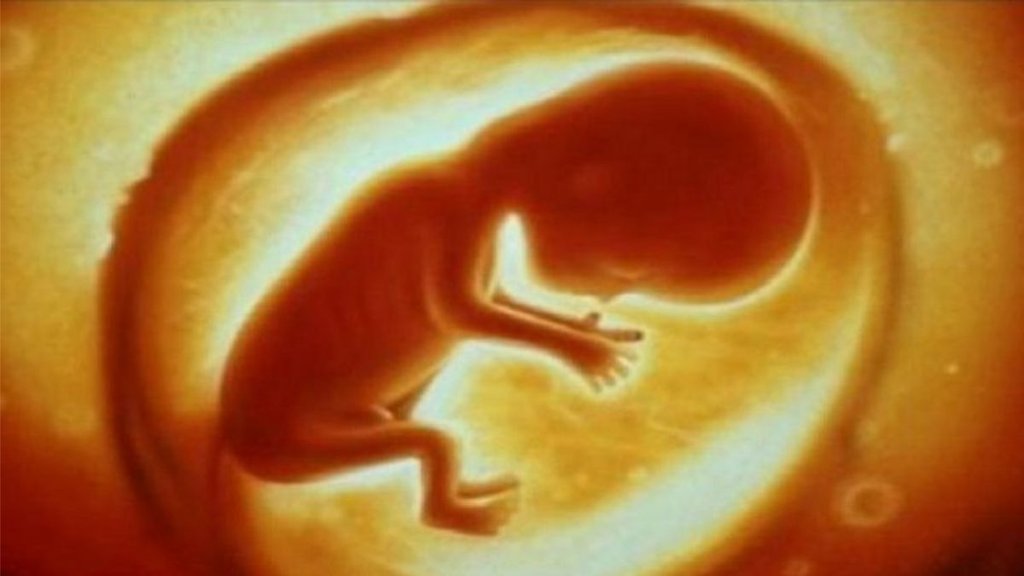 ghaziabad fetus, frtus news, ghaziabad news ghaziabad fetus, frtus news, ghaziabad news