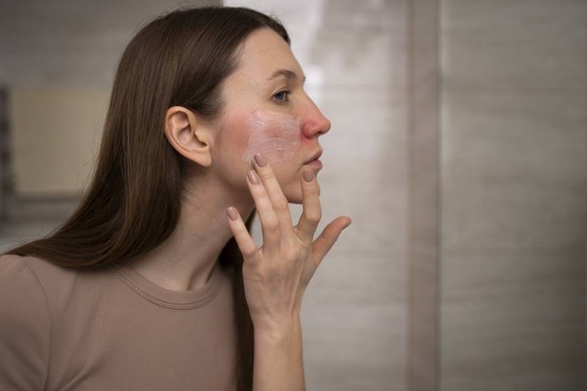 Why Use Malai on Face in Winters