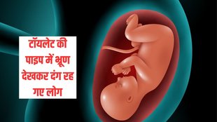 Ghaziabad| Ghaziabad News| Ghaziabad Foetus
