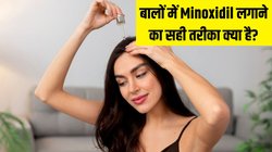 बालों में Minoxidil लगाने का सही तरीका क्या है? डर्मेटोलॉजिस्ट से जानें किस तरह यूज करने से मिलेगी Hair Growth में मदद