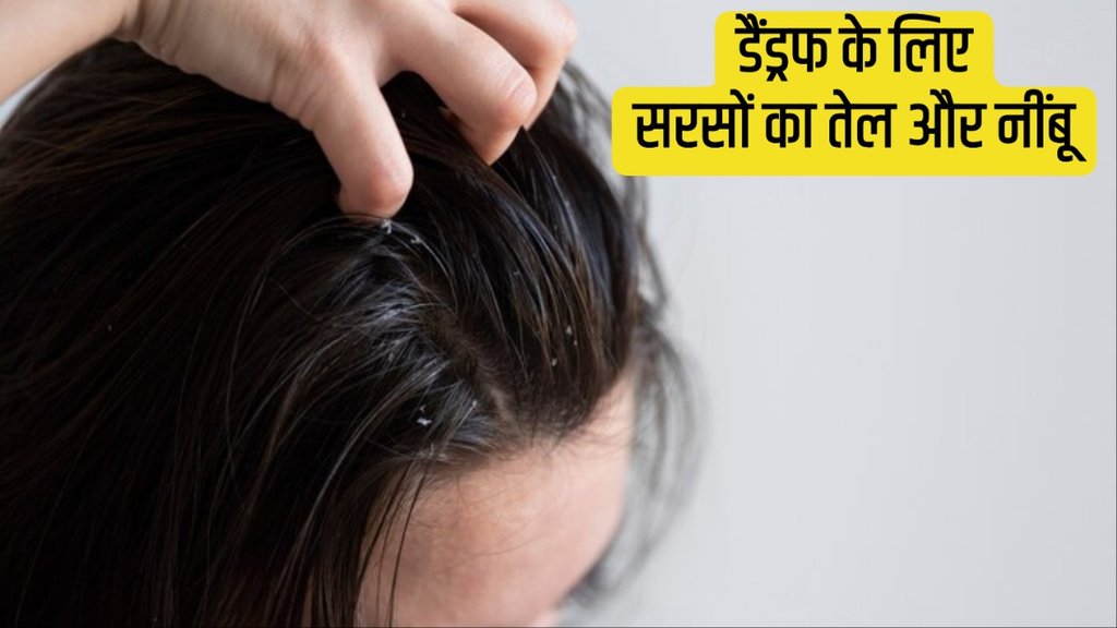 how to use mustard oil for dandruff
