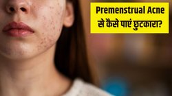 Premenstrual Acne: पीरियड में चेहरे पर हो जाते हैं एक्ने? Dermatologist ने बताया Periods में कैसे पाएं क्लियर स्किन, बस करने होंगे 5 आसान काम