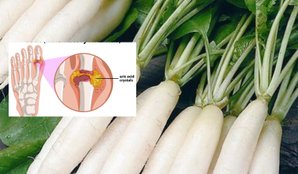 Radish Leaves for Uric Acid