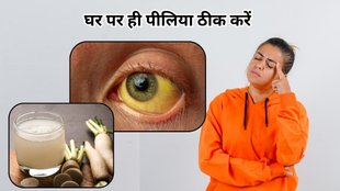 Radish juice for jaundice: मूली के जूस से करें पीलिया का इलाज