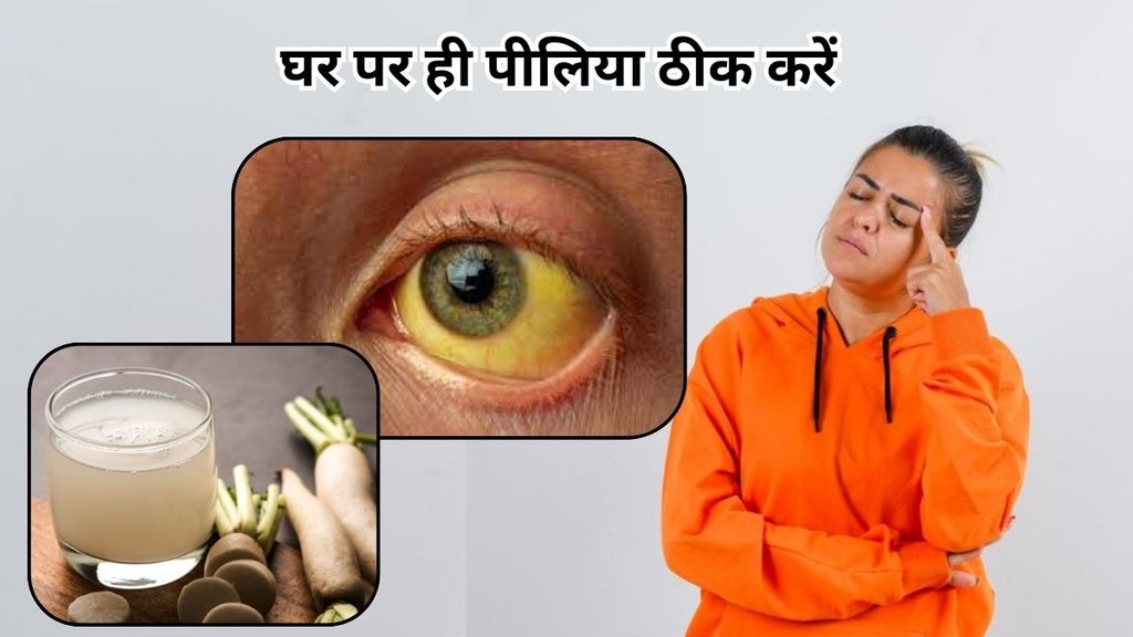 Radish juice for jaundice: मूली के जूस से करें पीलिया का इलाज