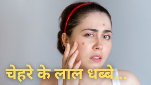 Red Spots On The Skin । Causes of Red Spots on Skin । Red Spots on Skin