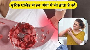 Uric Acid: यूरिक एसिड को कैसे कंट्रोल करें