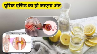 Uric Acid Control: नींबू के सेवन से यूरिक एसिड को कंट्रोल किया जा सकता है।