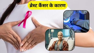causes of breast cancer: स्तन कैंसर के कारण