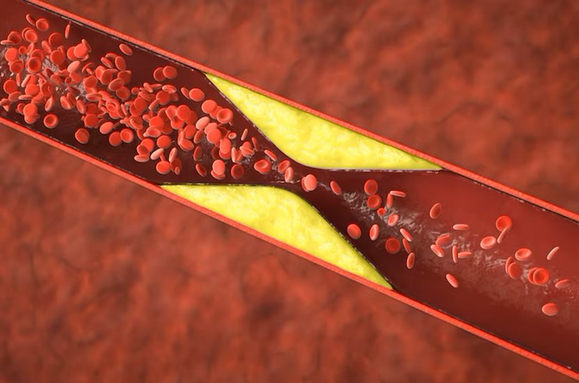 cholesterol