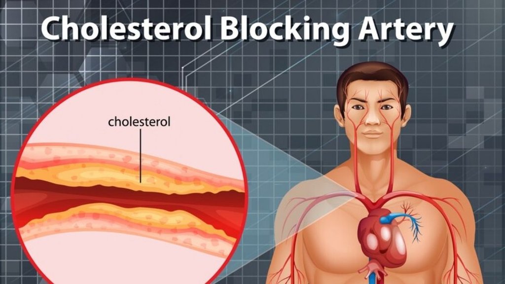 how to reduce Cholesterol: कोलेस्ट्रॉल कंट्रोल करने के लिए क्या करें